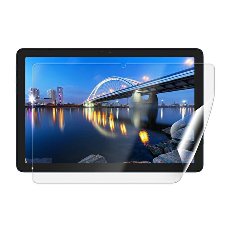 Screenshield IGET Smart L31 FullHD fólie na displej
